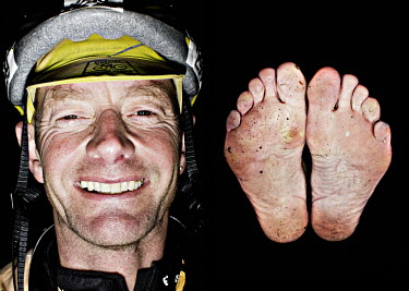 Tor Olav Trefjord and his feet after he has finished the bike race The Big Trial of Strength, stretching 540km from Trondheim to Oslo.