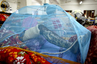 The badly injured and lacerated leg of one of the survivors of the collapsed Rana Plaza complex is shielded from the elements at the Pongu Hospital in Dhaka. The 8 storey Rana Plaza complex, which hou...