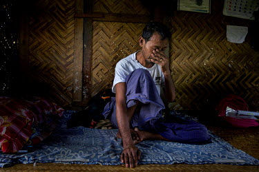 HIV positive U Than Gun, 52, who worked as a jade miner in Hpakant, where he used to inject heroin, rests at home in Myitkyina. Kachin state, where most of Myanmar's jade comes from, has some of the h...