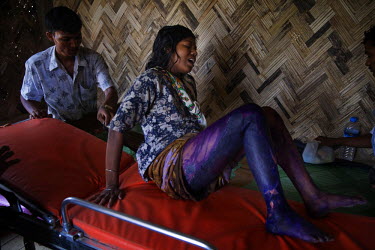 Rohingya woman Ma Gyi, 32, who has severe 1st degree burns to the back of both legs and genital area, is moved onto a gurney for transport by ambulance to Sittwe Hospital following a refferal from the...