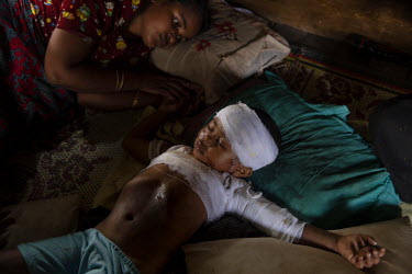Rohingya IDP Satara, 22, the mother of a five year old Gulshan watches over the the unconscious body of her daughter  who was knocked over by a motorbike. After failing to get emergency treatment they...