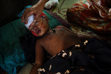 A relative checks the unconscious Gulshan, a five year old Rohingya IDP who was knocked over by a motorbike, at the Ministry of Heath's 'Dapaing Emergency Hospital' in the Rohingya segregated area nor...