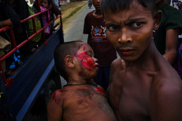 Rohingya IDP Abdul Razak, 27, holds the unconscious body of his five year old niece Gulshan, who was knocked over by a motorbike minutes earlier, outside the Ministry of Heath's 'Dapaing Emergency Hos...