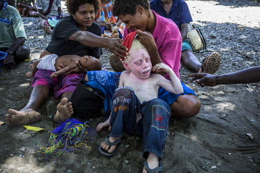 An albino boy with his mother during a meeting, where locals gathered to discuss seabed mining and climate change. Climate change is much discussed – not in the abstract, but as a presence. 'What wa...