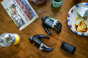 The bionic hands that Les Baugh uses lie on the kitchen table in Mr Baugh's home in Walden, Colorado. Les uses the hands to practice picking things up but the articulation is limited and they often br...