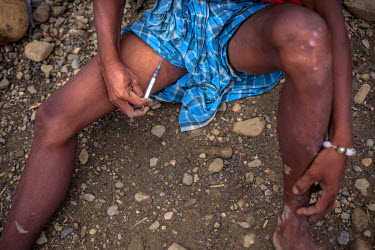 A miner injects heroin into a vein in his thigh at a 'shooting gallery' near a jade mining site. Heroin is almost openly available in Hpakant with miners lining up for a shot which is as cheap as 2,00...