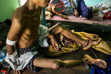 Maung Nan, 27, shackled to his hospital bed after he was arrested by police who then took him to hospital as they suspected he was infected with HIV. Nan has been mining jade since he was 10 years old...