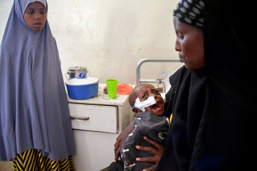 Saynab Ali Aden with her daughter Saleeban Ali Muuse (20 months old) at the hospital in Burao where Aden has brought them suffering from severe acute malnutrition. The family have lost much of their l...