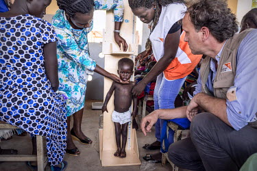 Aid workers examine a malnourished child at a medical centre.
