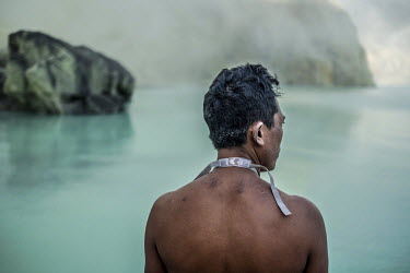 Miskadi, 36, reveals the scarring on his shoulders from 15 years of work as a sulphur miner in the Ijen crater. He calculates that he has climbed the crater over 6,000 times, each time carrying more t...