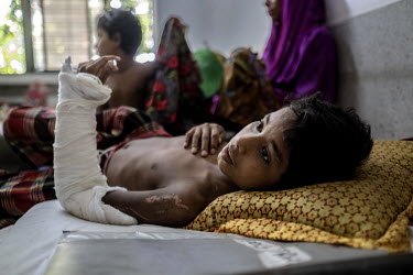 Robiul Alam (11) a Rohingya refugee, lies in the Sadar Hospital. Robiul says he had his arm broken by Burmese soldiers who raided his village in Myanmar's Rakhine state. 'They came to our house and hi...