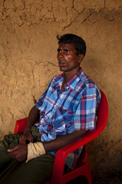 Ali Akbar (35) in the old Balukhali Refugee Camp. He says he risked his life travelling in an open boat to Shamlapur Beach after fleeing his home in Rakhine State. He was shot in the arm and leg as go...