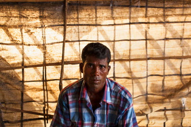 Ali Akbar (35) in the old Balukhali Refugee Camp. He says he risked his life travelling in an open boat to Shamlapur Beach after fleeing his home in Rakhine State. He was shot in the arm and leg as go...
