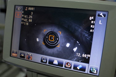 A scan of a cataract patient's eye.
