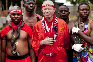 Texas Mwimba, former wrestling champion and activist for albino people.