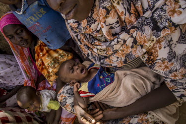 A woman holds in her malnourished son in her arms.