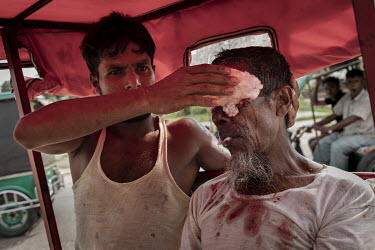 A man is rushed to the MSF hospital in Balukhali, with head injuries he received in a road traffic accident while riding a scooter. Traffic accidents are a very real danger in the Rohingya refugee cam...