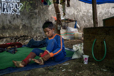 Child jockey Firmansyah (8) who fell from his horse during a race the day before, puts on elastic ankle supports before another race at the camp near the racecourse where his training team are based d...