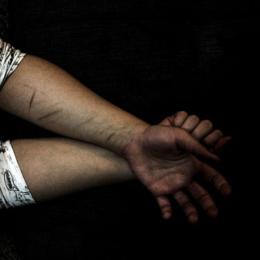 The self-harm scars of a young Syrian woman who has been trapped in an abusive relationship. Her education was interrupted at the age of 17 by her marriage to a young Syrian man who became abusive and...