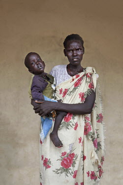 Abuk Cham (32) with her baby who is being treated at a mother and baby nutrition clinic for malnourished children.