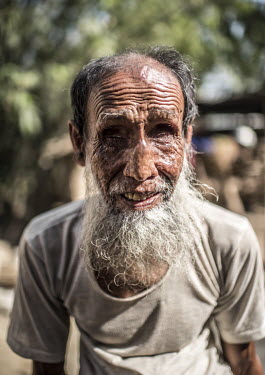 Abdul Khader, who has been blind since childhood, at his home in Harinakunda.
