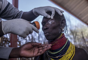 Samson Lokele, the Sightsavers Eye Care focal point for Turkana, examines Ipo Nabur a few days before her eye surgery.