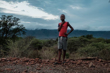 Mdududzi Gcina (14) near his home close to Big Bend. When he was four he was bitten on both arms by a Mozambique spitting cobra while sleeping. It took several operations to save his arms. He and his...