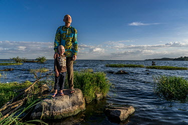Ramadhan Khalfan (48) and his son Abdallah, who are both albinos, stand beside Lake Victoria on Ukerewe Island. In Tanzania, albinos account for one birth out of every 1,429, a rate significantly high...