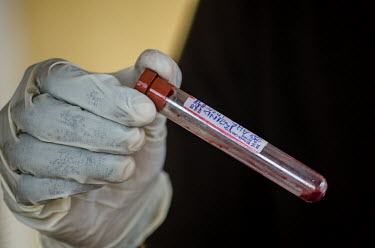 A medical worker holds a blood sample from a suspected Ebola patient.
