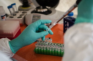 A laboratory technician tests samples at an Ebola treatment centre.