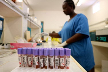 Blood samples that are to be tested for HIV at the UNICEF supported 'Ceu e Terras' health centre.