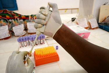 Blood samples that are to be tested for HIV at the UNICEF supported 'Ceu e Terras' health centre.