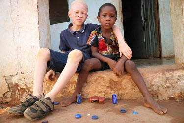 Sergio (9), who is an albino and has issues with his sight,  plays outside with his brother Ritos Mendonca (4).