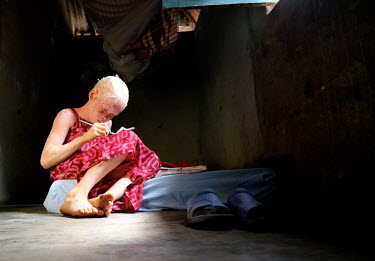 Neusa (9) at home doing her homework in her bedroom. Neusa is an albino child and has sensitive skin and eyes. She was living with her father in a village, but he did not take appropriate care of her...