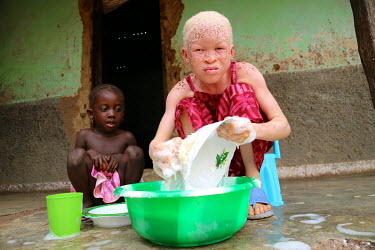 Neusa (9) at home washing dishes to help her aunt. Neusa is an albino child and has sensitive skin and eyes. She was living with her father in a village, but he did not take appropriate care of her an...