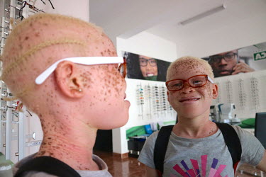 Neusa (9), who is an albino and has issues with her sight, smiles as she visits an opticians to choose new glasses