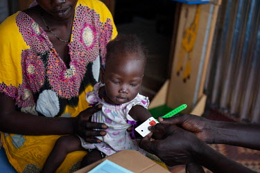 Dehlia (18) holds her seven month old baby Koaloch on her lap as she is given a MUAC test (mid-upper arm circumference) at a nutrition clinic in Protection of Civilians (PoC) camp 3.