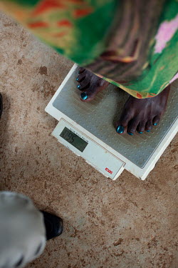 Nyachiew (26), is weighed at a nutrition clinic in Protection of Civilians (PoC) camp 3. Nyachiew, an ethnic Nuer, has lived in the PoC for six years. Her children have been treated for malnourishment...