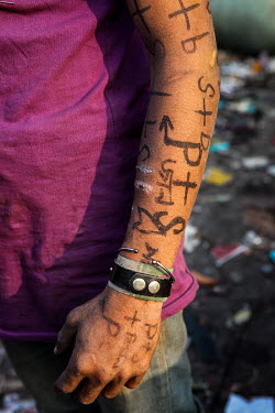 A street boy who has self harm scars and words written with felt pen on his arms.  It is estimated that there are more than 600,000 street children living in Bangladesh, 75% of them live in the nation...