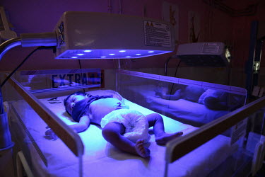 A premature baby sleeps beneath an ultra violet (UV) light while undergoing treatment in the Phototherapy Ward at the Virangna Avanti Bai District Women's Hospital.