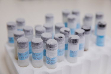 Samples of THC (tetrahydrocannabinol) and CBD (cannabidiol) used in the preparation of medicinal products for treating gynecological issues by Lumir Lab, a Israeli cannabis start-up.