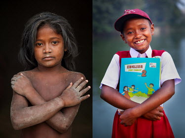 A child covered in dust from labouring in a grain mill (left) and the same girl after she stopped labouring and started to attend school.