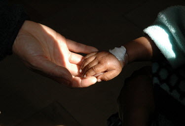 An HIV positive child being treated at the Maluti Hospital.