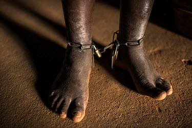 Chains shackling the ankles of a patient being treated for mental health issues at Oke Oloro where the use of chains to restrain people is common practice. Traditional healer Sheu Saliu Ibrahim, who r...