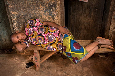 A patient lies on a bench at Oke Oloro where the shackling mental health patient's ankles is common practice. Traditional healer Sheu Saliu Ibrahim, who runs the clinic, uses herbal medicine and praye...