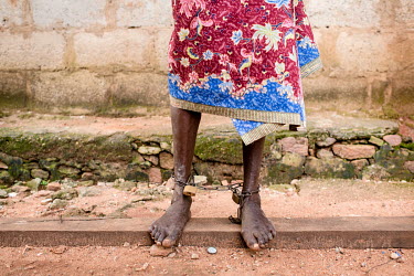 A patient whose ankles have been shackled at Oke Oloro where the shackling of mental health patient's ankles is common practice. Traditional healer Sheu Saliu Ibrahim, who runs the clinic, uses herbal...