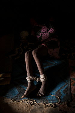 A patient whose ankles are shackled with rope and crepe bandages lies on a mat in a small dark cell at the Emmanuel Rehabilitation Centre for Mentally Ill People which is run by Miss Mojisola Adeniyi....