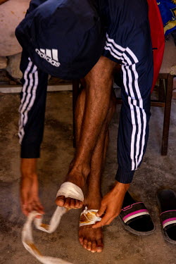 A migrant binds his feet in the former women's prison on Salcha Beach. The man is one of around 16,000 people who gained access to the exclave during three days in May 2021 (17th, 18th & 19th). During...