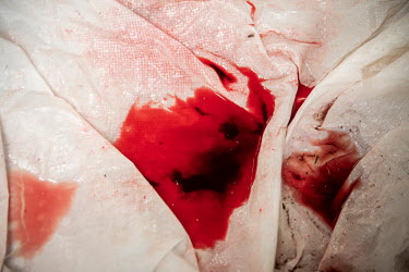 Blood of a dead pig on a sheet.