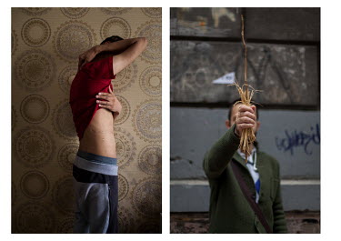 LEFT: Danial, a gay man from Iran, showing the scars on his body from when he sold one of his kidneys to pay for his passage to Turkey, where he currently lives whilst applying for resettlement to a t...
